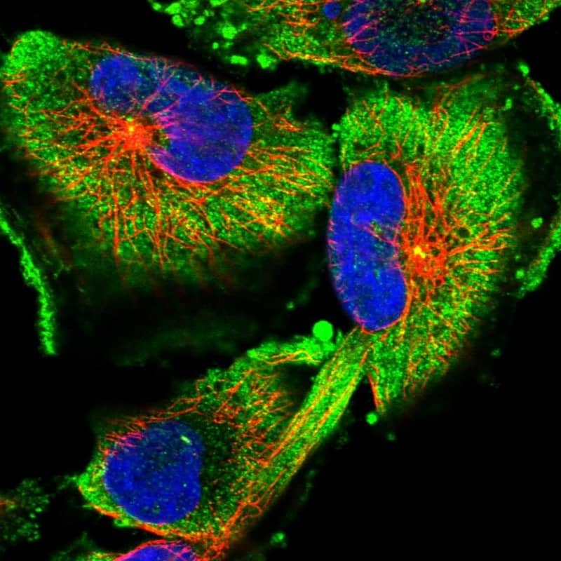 Staining of human cell line U-251 MG shows localization to plasma membrane, cytosol & centrosome.