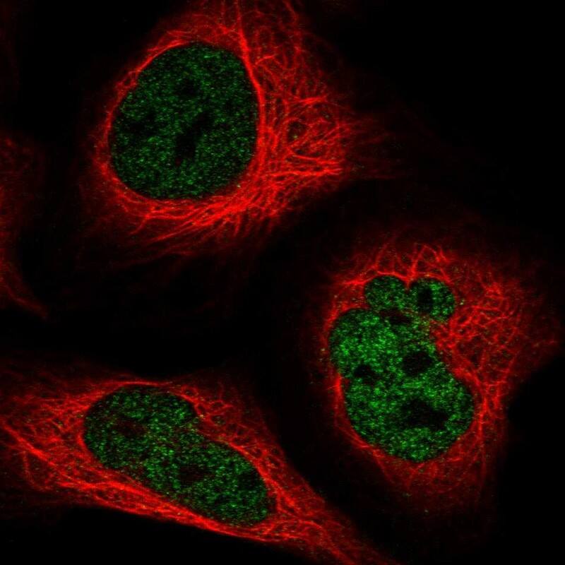 Immunocytochemistry/ Immunofluorescence ADAT1 Antibody - BSA Free