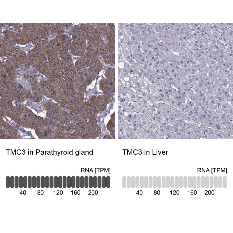 Immunohistochemistry-Paraffin TMC3 Antibody - BSA Free