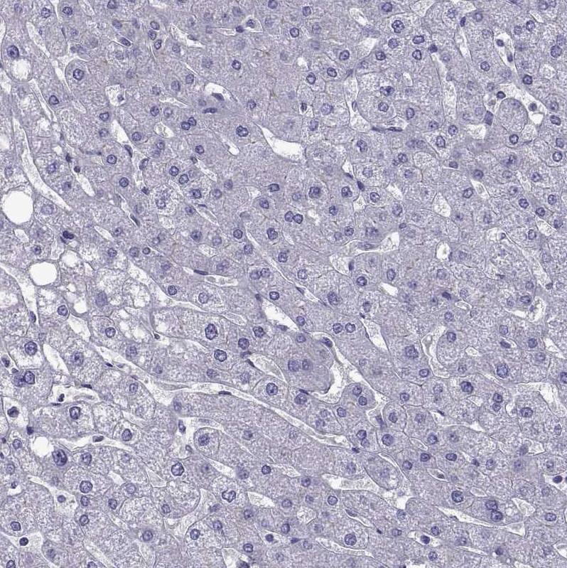Staining of human liver shows no positivity in hepatocytes as expected.