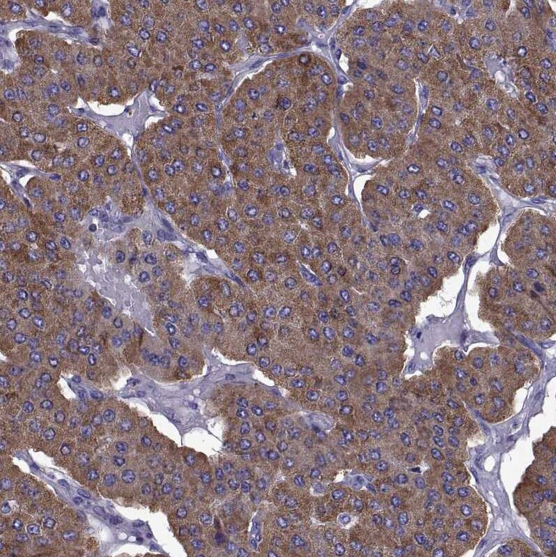 Staining of human parathyroid gland shows strong cytoplasmic positivity in glandular cells.
