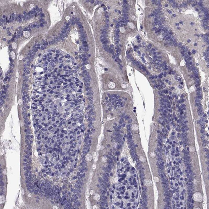 Staining of human duodenum shows no positivity in glandular cells as expected.