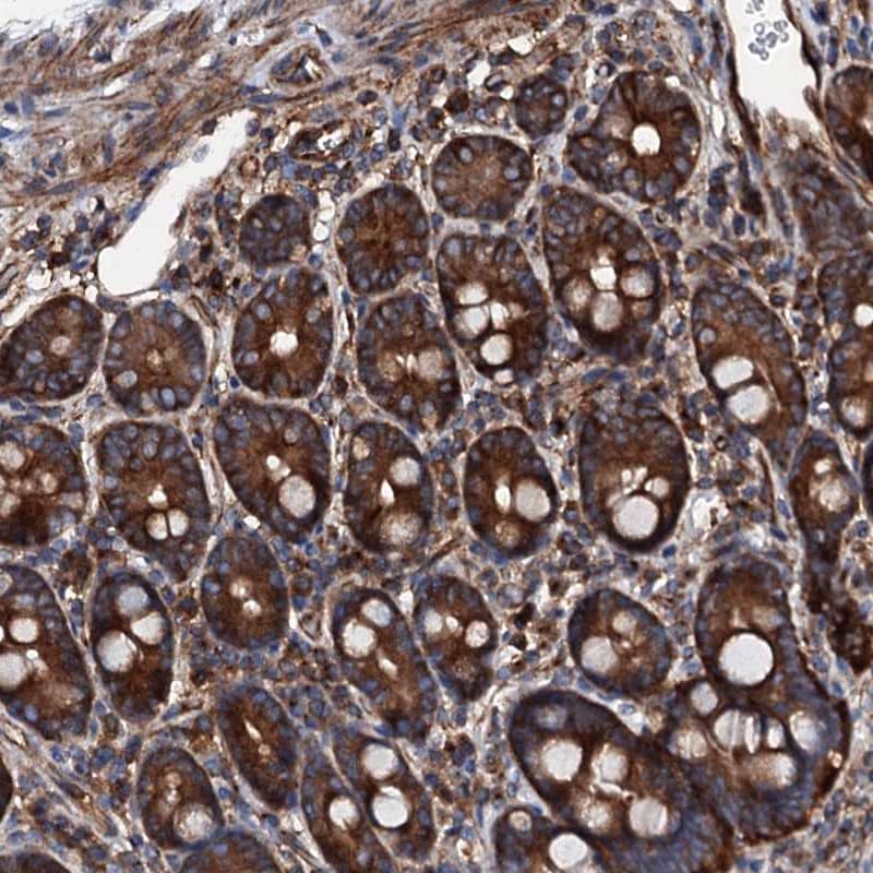Immunohistochemistry-Paraffin MOS Antibody - BSA Free