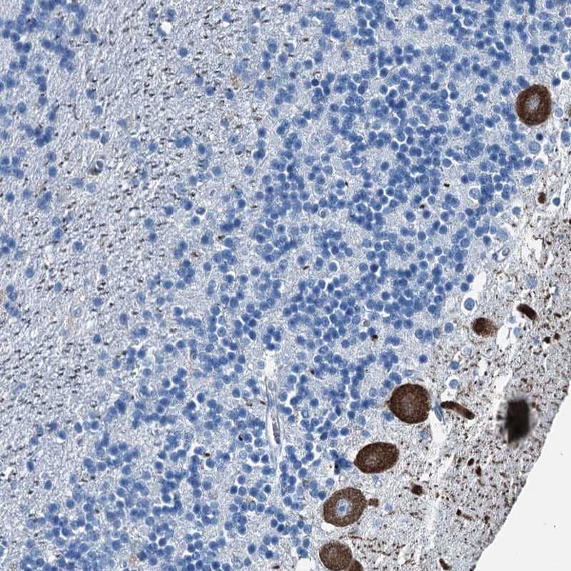 Staining of human cerebellum shows strong cytoplasmic staining in Purkinje cells.