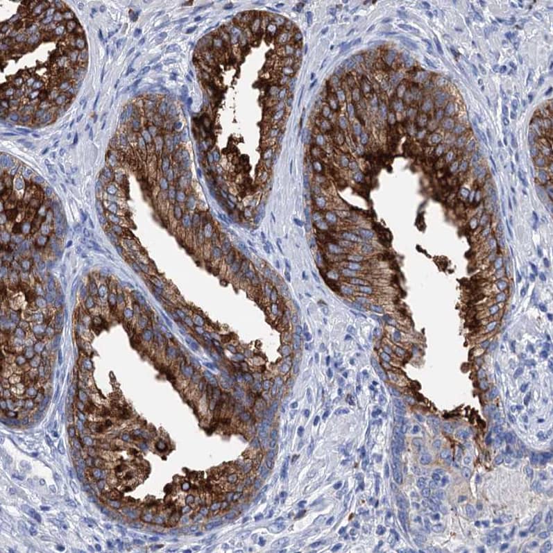 Immunohistochemistry-Paraffin BBS4 Antibody - BSA Free