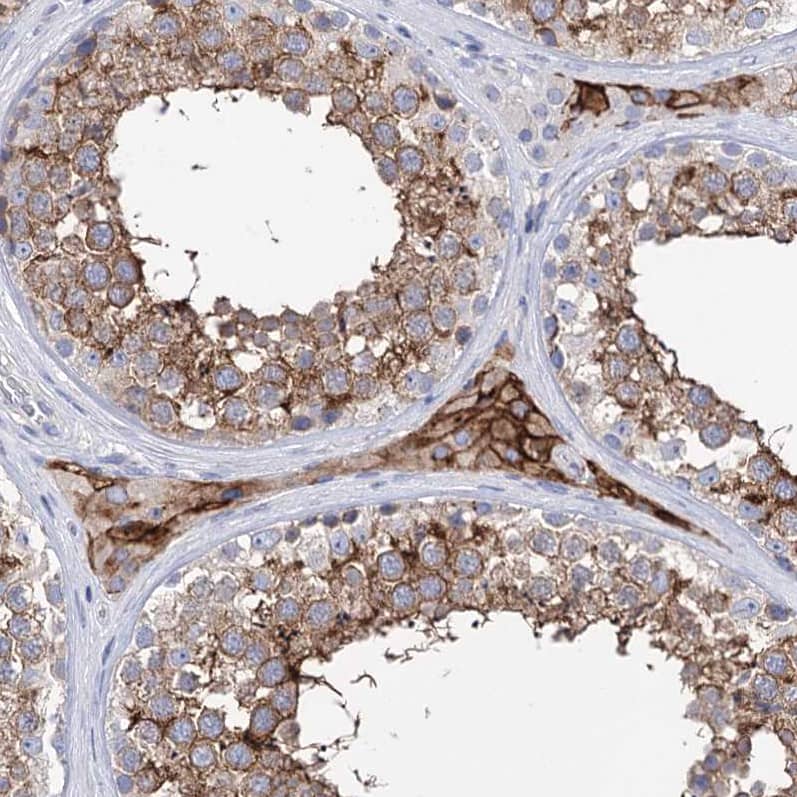 Staining of human testis shows strong membranous positivity in Leydig cells.