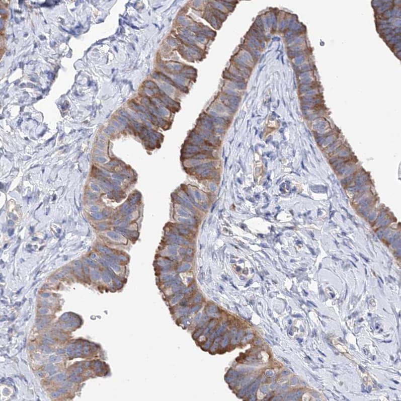 Staining of human Fallopian tube shows moderate membranous and cytoplasmic positivity in glandular cells.