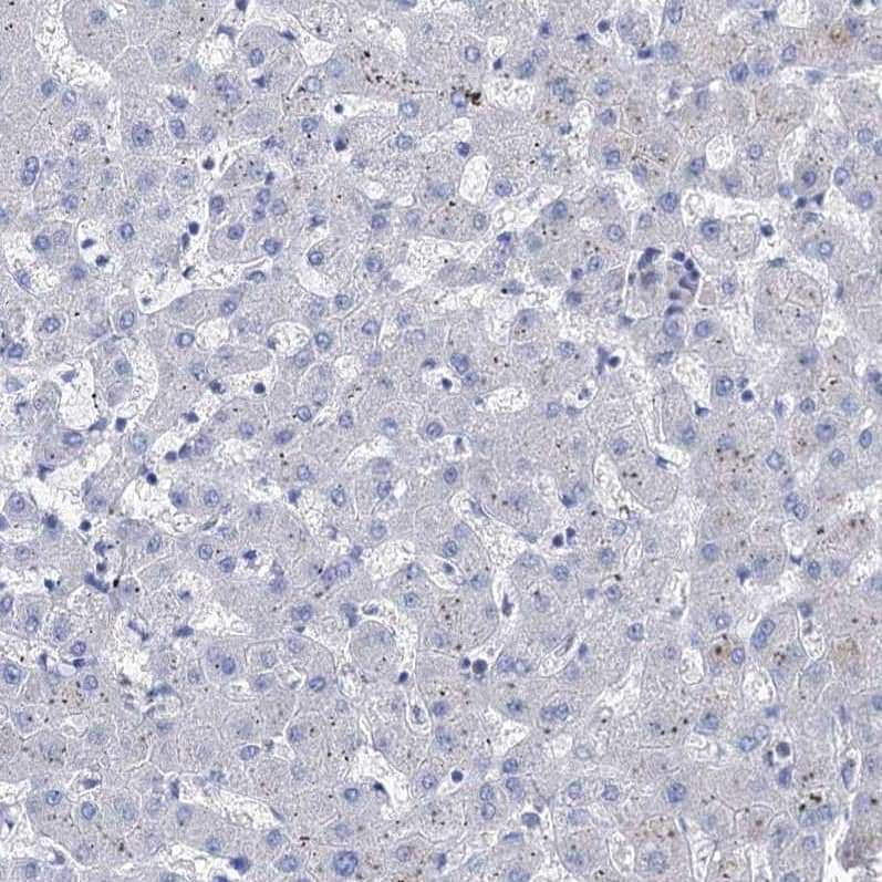 Immunohistochemistry-Paraffin BBS4 Antibody - BSA Free