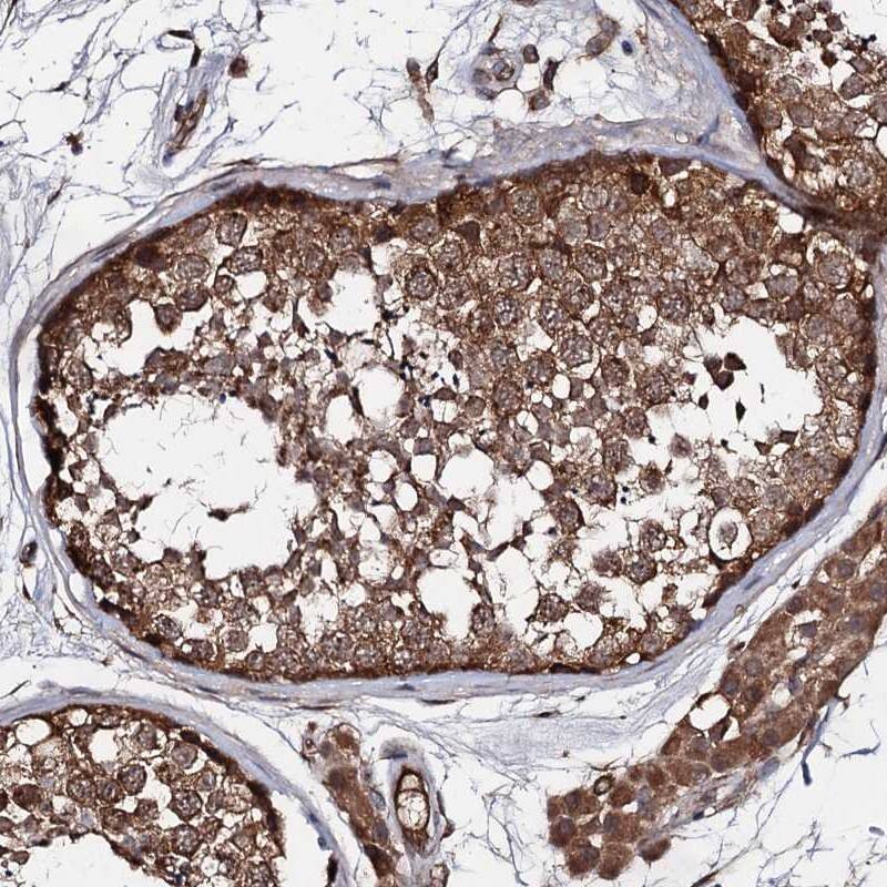 Immunohistochemistry-Paraffin TEX9 Antibody - BSA Free