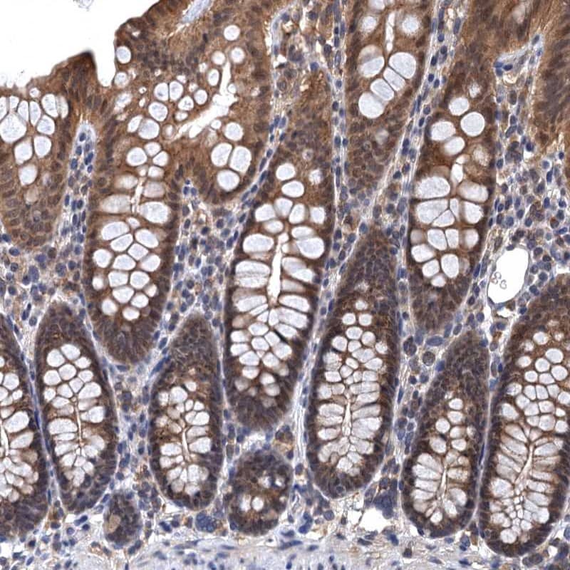 Staining of human colon shows moderate cytoplasmic positivity in glandular cells.