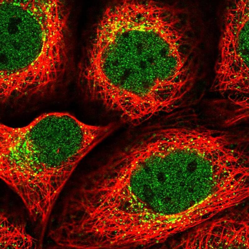 Staining of human cell line A-431 shows localization to nucleoplasm & vesicles.