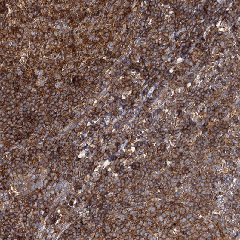 Immunohistochemistry-Paraffin SEC24B Antibody - BSA Free