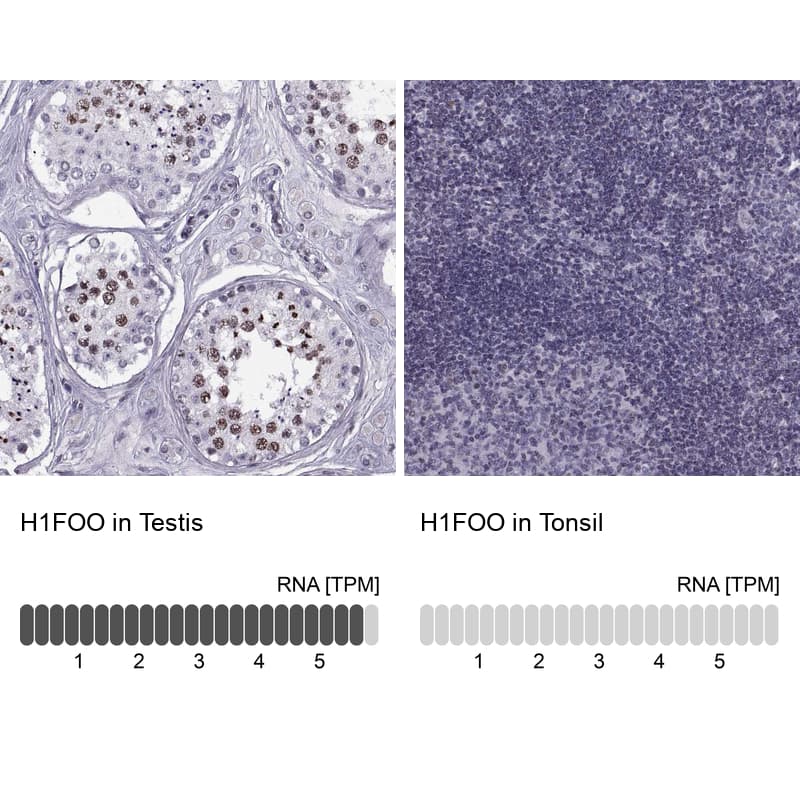 Immunohistochemistry-Paraffin H1FOO Antibody - BSA Free