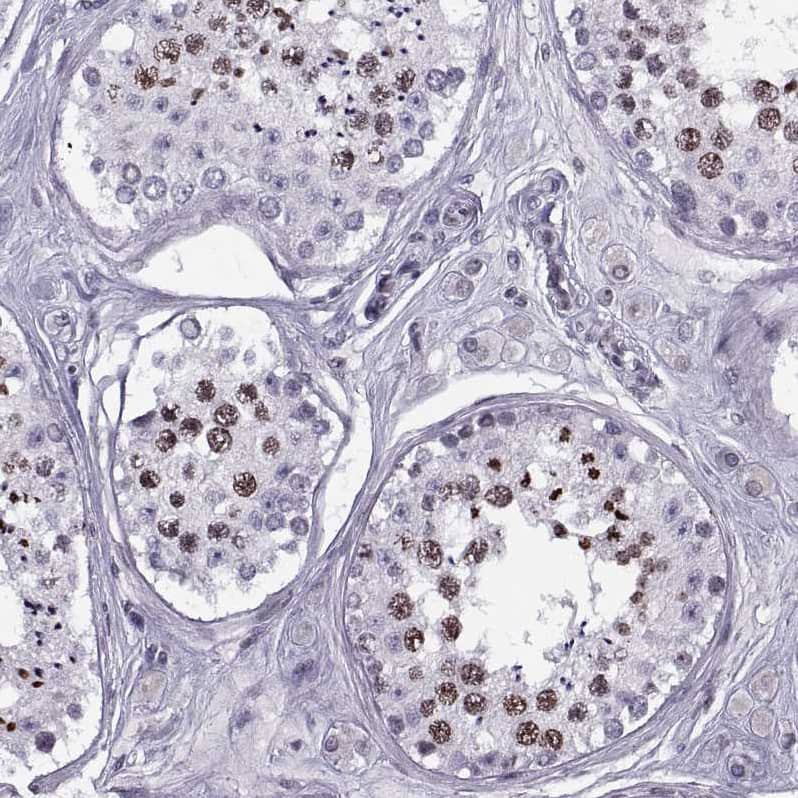 Immunohistochemistry-Paraffin H1FOO Antibody - BSA Free