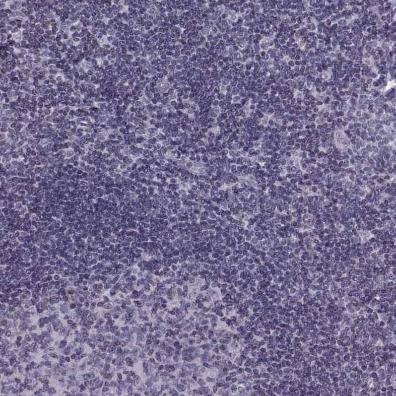 Staining of human Tonsil shows no positivity in non-germinal center cells as expected.