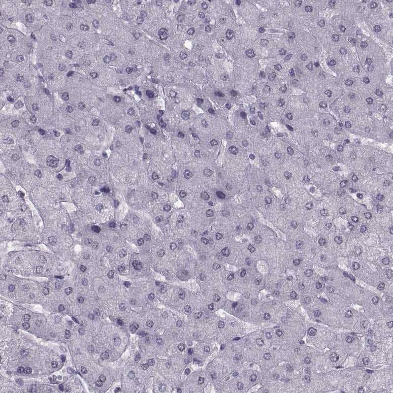 Staining of human Liver shows no positivity in hepatocytes as expected.
