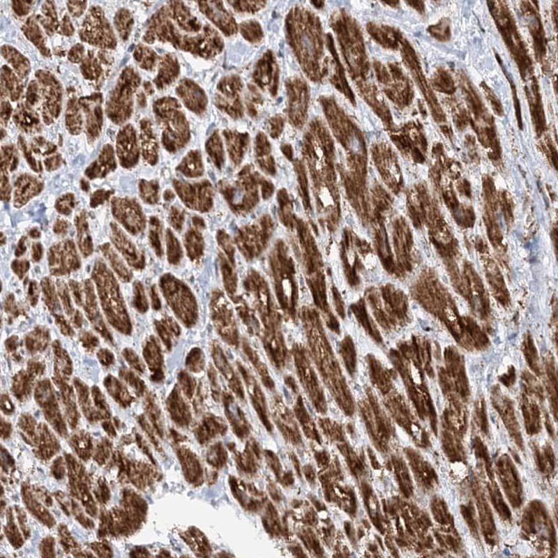 Staining of human heart muscle shows strong cytoplasmic positivity in myocytes.