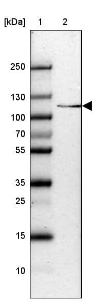 Lane 1: Marker [kDa] 250, 130, 100, 70, 55, 35, 25, 15, 10Lane 2: Human cell line HepG2