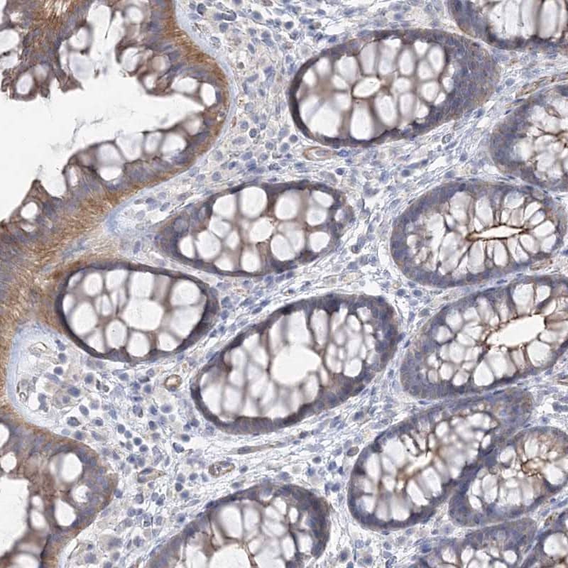 Immunohistochemistry-Paraffin PIGC Antibody - BSA Free