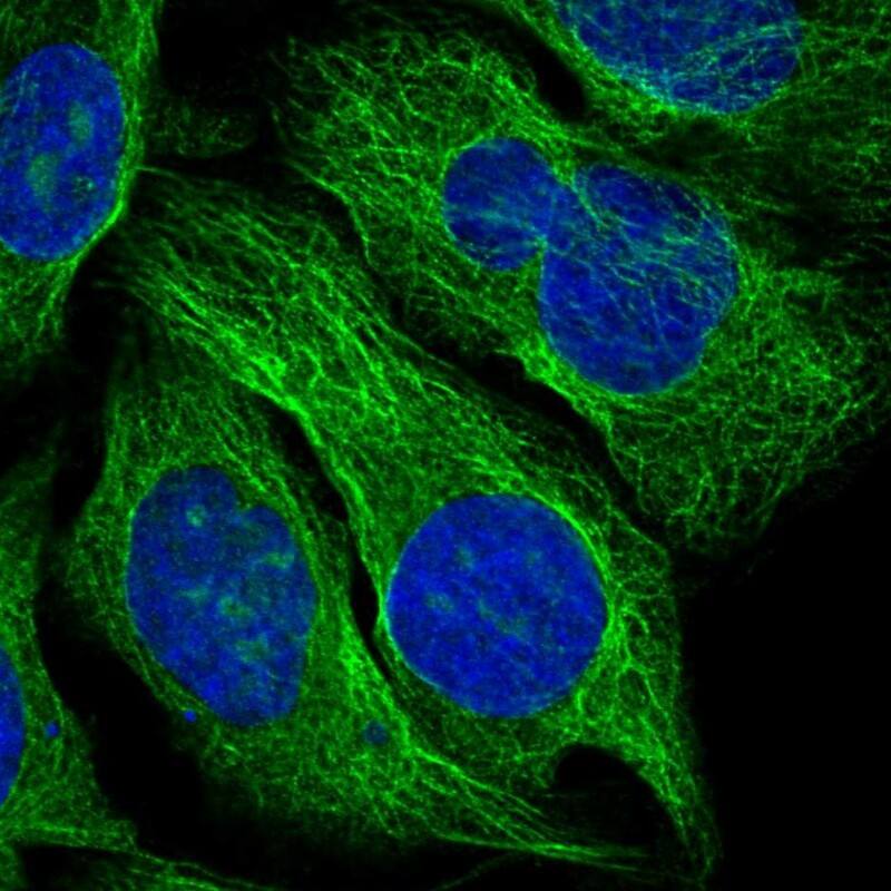 Immunohistochemistry-Paraffin TBCA Antibody - BSA Free