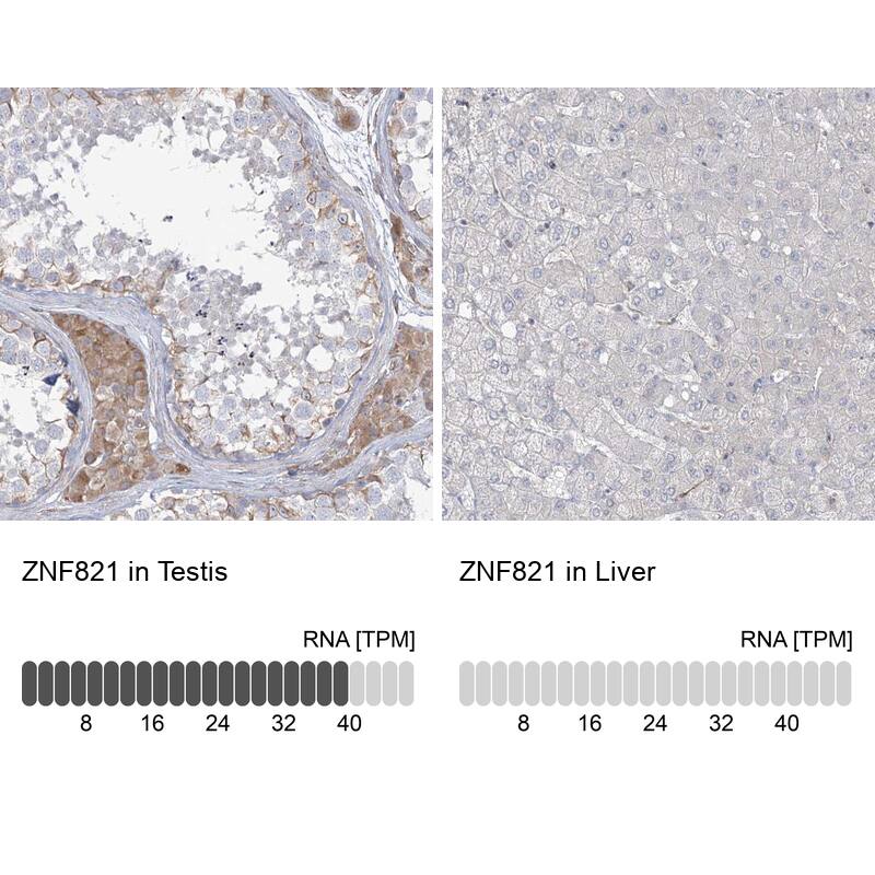 Immunohistochemistry-Paraffin ZNF821 Antibody - BSA Free