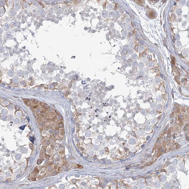 Immunohistochemistry-Paraffin ZNF821 Antibody - BSA Free