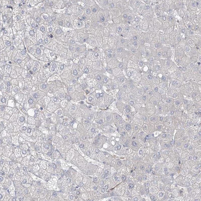 Immunohistochemistry-Paraffin ZNF821 Antibody - BSA Free