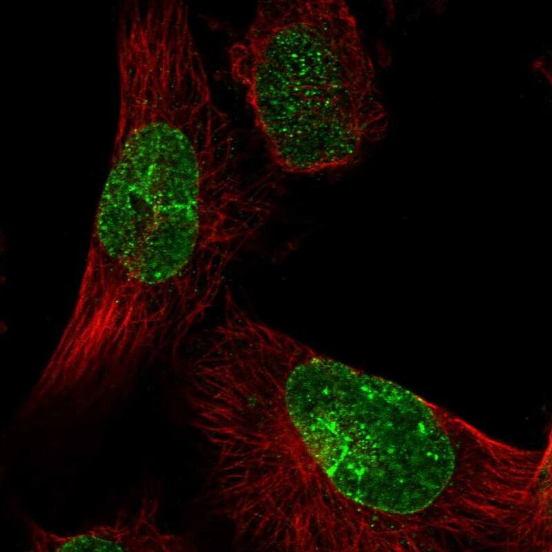 Staining of human cell line U-251 MG shows localization to nuclear membrane.