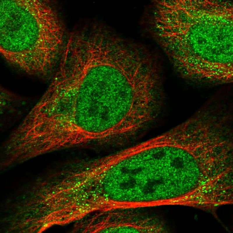 Staining of human cell line U-2 OS shows localization to nucleoplasm & vesicles.
