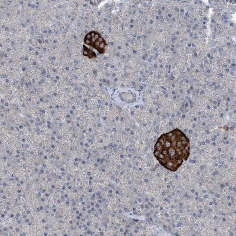Staining of human pancreas shows strong cytoplasmic positivity in islet cells.