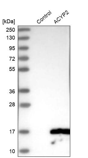 Western Blot ACYP2 Antibody - BSA Free
