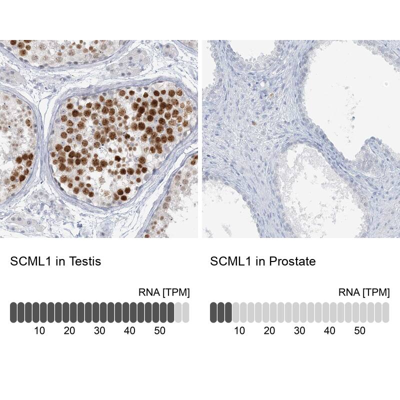 <b>Orthogonal Strategies Validation. </b>Analysis in human testis and prostate tissues.