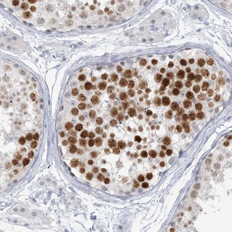 Staining of human testis shows high expression.