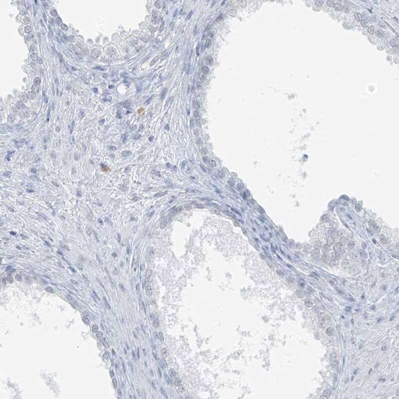 Staining of human prostate shows low expression as expected.
