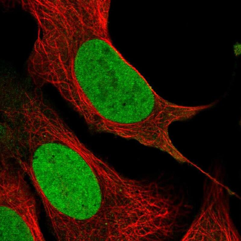 Immunohistochemistry-Paraffin PCNP Antibody - BSA Free