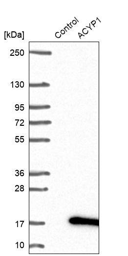 Analysis in control (vector only transfected HEK293T lysate) and ACYP1 over-expression lysate (Co-expressed with a C-terminal myc-DDK tag (~3.1 kDa) in mammalian HEK293T cells).
