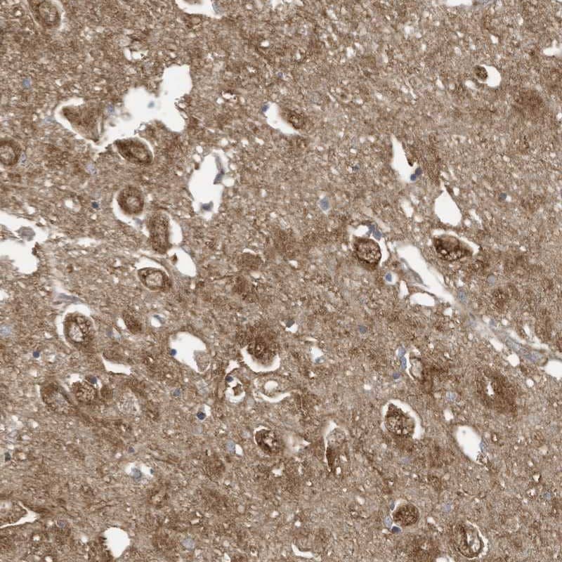 Staining of human hippocampus shows strong cytoplasmic positivity in neuronal cells.