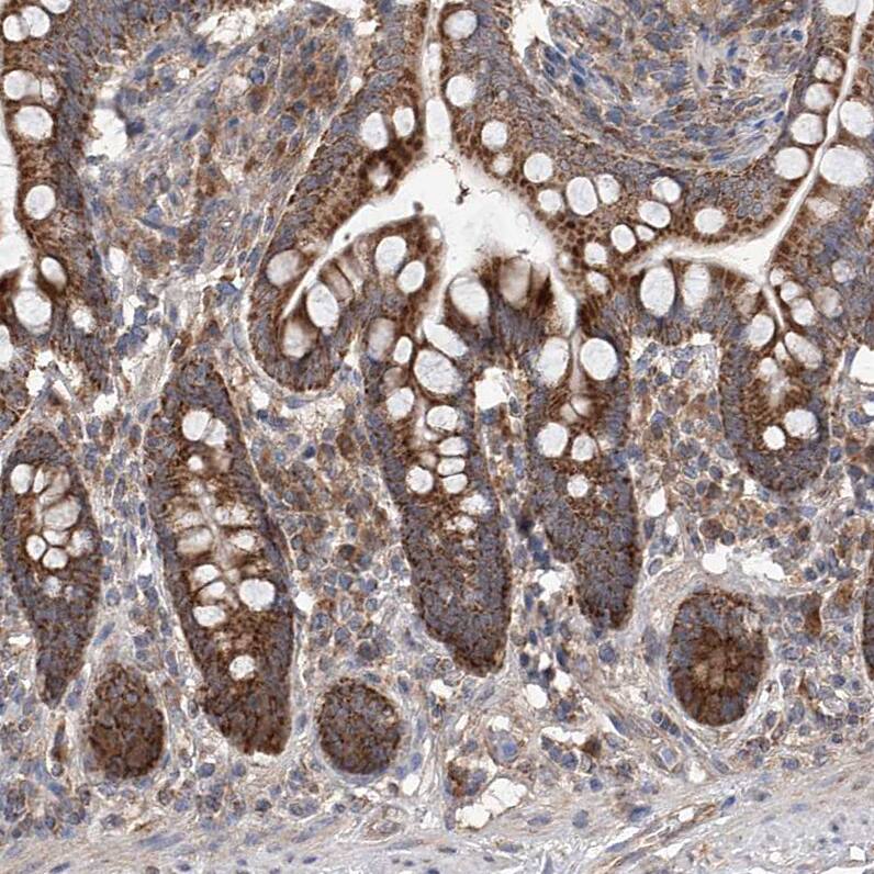 Immunohistochemistry-Paraffin SDHAF4 Antibody - BSA Free