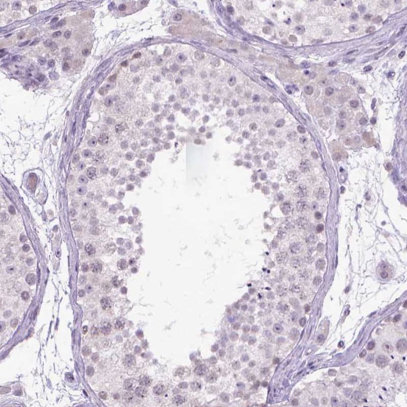 Staining of human testis shows no positivity in cells in seminiferous ducts as expected.