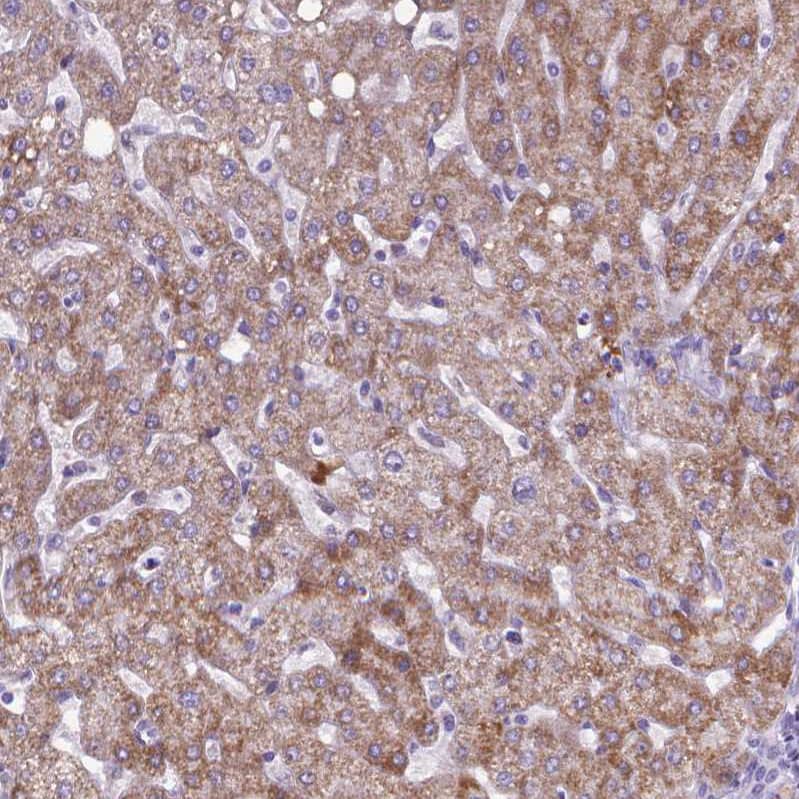 Staining of human liver shows strong cytoplasmic granular positivity in hepatocytes.