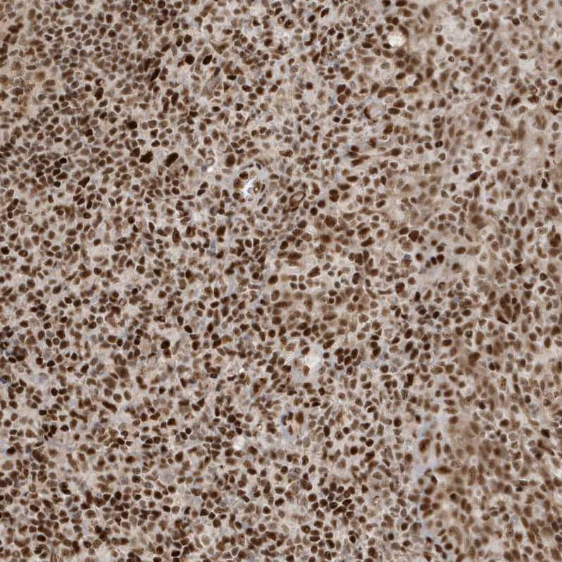 Staining of human tonsil shows strong nuclear positivity in non-germinal center cells.