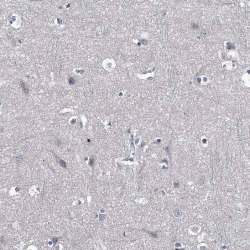 Staining of human cerebral cortex shows no positivity in neuronal cells as expected.