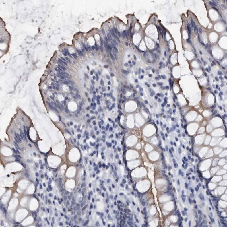 Staining of human rectum shows strong positivity in apical membrane in glandular cells.