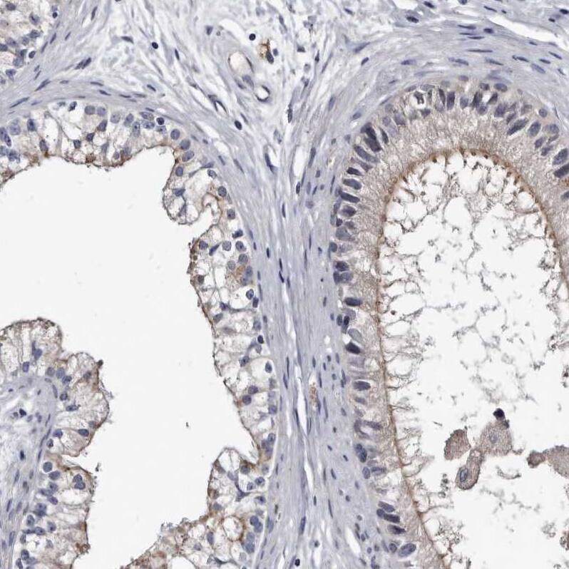 Staining of human epididymis shows moderate positivity in apical membrane in glandular cells.