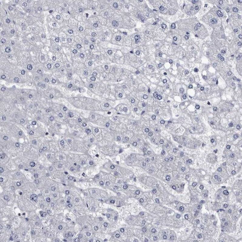 Staining of human liver shows no positivity in hepatocytes as expected.