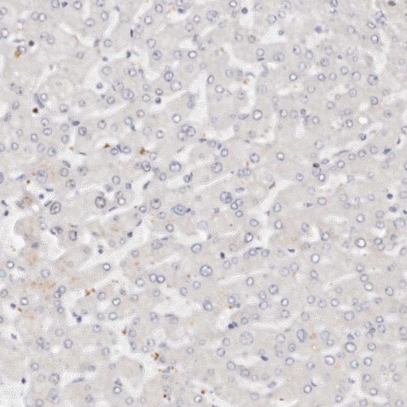 Immunohistochemistry-Paraffin IQGAP3 Antibody - BSA Free