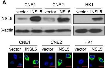 INSL5 promotes the progression of NPC via accelerating cell proliferation and invasion depending on GPCR142AExogenous expression of INSL5 in NPC cells. Representative immunoblotting (upper panel) and immunofluorescent staining (lower panel) showed stable exogenous expression of INSL5 in both CNE1, CNE2, and HK1 NPC cell lines. Scale bars represent 20 μm.BMTT assay of vector control or INSL5 overexpressing CNE1, CNE2, and HK1 NPC cell lines (upper panel) either transfected with control siRNA (NC) or GPCR142 siRNA (#1 and #2) (lower panel). n = 4 biological replicates for CNE1 and CNE2 cell line, n = 6 biological replicates for HK1.C–HColony formation (C and D), Brdu incorporation (E and F), and migration assays (G and H) of vector control or INSL5 overexpressing CNE1, CNE2, and HK1 NPC cell lines either transfected with control siRNA (NC) or GPCR142 siRNA (#1 and #2). Representative images are shown in (C), (E), and (G) for colony formation, Brdu incorporation, and migration assays, respectively. Number of colonies, the percentage of Brdu positive cells, and migrated cells per field of view were plotted in (D, F, and H), respectively. The results are from three different experiments. Scale bars represent 20 μm in (E) and 100 μm in (G)I, JXenograft tumor growth of INSL5 overexpression NPC HK1 stable cell lines in nude mice. Tumor size (I) and tumor weight (J) of two groups. n = 11 mice per group.Data information: In (B, I, and J), data are presented as mean +/- SD, in (D, F, and H), data are presented as mean +/- SEM, from three different experiments, and P‐values were determined by unpaired t‐test. *P < 0.05, **P < 0.01, ***P < 0.001, ns, no significance. Exact P‐values are specified in Appendix Table S4.Source data are available online for this figure. Image collected and cropped by CiteAb from the following open publication (//pubmed.ncbi.nlm.nih.gov/32657028), licensed under a CC-BY license. Not internally tested by Novus Biologicals.
