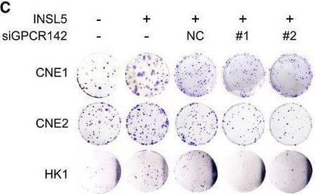INSL5 promotes the progression of NPC via accelerating cell proliferation and invasion depending on GPCR142AExogenous expression of INSL5 in NPC cells. Representative immunoblotting (upper panel) and immunofluorescent staining (lower panel) showed stable exogenous expression of INSL5 in both CNE1, CNE2, and HK1 NPC cell lines. Scale bars represent 20 μm.BMTT assay of vector control or INSL5 overexpressing CNE1, CNE2, and HK1 NPC cell lines (upper panel) either transfected with control siRNA (NC) or GPCR142 siRNA (#1 and #2) (lower panel). n = 4 biological replicates for CNE1 and CNE2 cell line, n = 6 biological replicates for HK1.C–HColony formation (C and D), Brdu incorporation (E and F), and migration assays (G and H) of vector control or INSL5 overexpressing CNE1, CNE2, and HK1 NPC cell lines either transfected with control siRNA (NC) or GPCR142 siRNA (#1 and #2). Representative images are shown in (C), (E), and (G) for colony formation, Brdu incorporation, and migration assays, respectively. Number of colonies, the percentage of Brdu positive cells, and migrated cells per field of view were plotted in (D, F, and H), respectively. The results are from three different experiments. Scale bars represent 20 μm in (E) and 100 μm in (G)I, JXenograft tumor growth of INSL5 overexpression NPC HK1 stable cell lines in nude mice. Tumor size (I) and tumor weight (J) of two groups. n = 11 mice per group.Data information: In (B, I, and J), data are presented as mean +/- SD, in (D, F, and H), data are presented as mean +/- SEM, from three different experiments, and P‐values were determined by unpaired t‐test. *P < 0.05, **P < 0.01, ***P < 0.001, ns, no significance. Exact P‐values are specified in Appendix Table S4.Source data are available online for this figure. Image collected and cropped by CiteAb from the following open publication (//pubmed.ncbi.nlm.nih.gov/32657028), licensed under a CC-BY license. Not internally tested by Novus Biologicals.