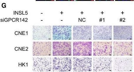 INSL5 promotes the progression of NPC via accelerating cell proliferation and invasion depending on GPCR142AExogenous expression of INSL5 in NPC cells. Representative immunoblotting (upper panel) and immunofluorescent staining (lower panel) showed stable exogenous expression of INSL5 in both CNE1, CNE2, and HK1 NPC cell lines. Scale bars represent 20 μm.BMTT assay of vector control or INSL5 overexpressing CNE1, CNE2, and HK1 NPC cell lines (upper panel) either transfected with control siRNA (NC) or GPCR142 siRNA (#1 and #2) (lower panel). n = 4 biological replicates for CNE1 and CNE2 cell line, n = 6 biological replicates for HK1.C–HColony formation (C and D), Brdu incorporation (E and F), and migration assays (G and H) of vector control or INSL5 overexpressing CNE1, CNE2, and HK1 NPC cell lines either transfected with control siRNA (NC) or GPCR142 siRNA (#1 and #2). Representative images are shown in (C), (E), and (G) for colony formation, Brdu incorporation, and migration assays, respectively. Number of colonies, the percentage of Brdu positive cells, and migrated cells per field of view were plotted in (D, F, and H), respectively. The results are from three different experiments. Scale bars represent 20 μm in (E) and 100 μm in (G)I, JXenograft tumor growth of INSL5 overexpression NPC HK1 stable cell lines in nude mice. Tumor size (I) and tumor weight (J) of two groups. n = 11 mice per group.Data information: In (B, I, and J), data are presented as mean +/- SD, in (D, F, and H), data are presented as mean +/- SEM, from three different experiments, and P‐values were determined by unpaired t‐test. *P < 0.05, **P < 0.01, ***P < 0.001, ns, no significance. Exact P‐values are specified in Appendix Table S4.Source data are available online for this figure. Image collected and cropped by CiteAb from the following open publication (//pubmed.ncbi.nlm.nih.gov/32657028), licensed under a CC-BY license. Not internally tested by Novus Biologicals.