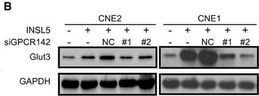 INSL5 induces glucose metabolism to aerobic glycolysis reprogramming in NPC cellsAAnalysis of glycolytic gene expression by qRT–PCR in INSL5 overexpressed CNE1 cell lines.BAnalysis of glycolytic gene expression by immunoblot in INSL5 overexpressing cells with or without GPCR142 knockdown.C–EThe metabolomics identified increased glycolytic intermediate metabolites in INSL5 overexpressed CNE1 cells (C), CNE2 cells (D), and HK1 cells (E). CNE1 and HK1 were from five independent samples, and CNE2 were from seven independent samples.FSchematic diagram of aerobic glycolysis pathway and TCA pathway. Red: INSL5 upregulated glycolytic genes and metabolites. Green: INSL5 downregulated TCA intermediates.GThe extracellular acidification rate (ECAR) was measured in cells with or without INSL5 overexpression using a Seahorse XF96 Extracellular Flux analyzer.HThe oxygen consumption rate (OCR) was measured in cells with or without INSL5 overexpression using a Seahorse XF96 Extracellular Flux analyzer.I–LGlucose uptake (I), HK2 enzyme activity (J), ATP concentration (K), and lactate production (L) in CNE2 and HK1 stable cells.MGlucose uptake in CNE2 wide‐type or GPCR142 knockdown cells stimulated with INSL5 peptide (50 ng/ml) for 24 h.NATP concentration, HK2 enzyme activity, and lactate production in INSL5 wide‐type or knockdown CNE2‐EBV cells.Data information: In (G–I, M and N), data are presented as mean +/- SEM, in (C–E and J–L), data are presented as mean +/- SD, from three different experiments, and P‐values were determined by unpaired t‐test. *P < 0.05, **P < 0.01, ***P < 0.001, ns, no significance. Exact P‐values are specified in Appendix Table S4.Source data are available online for this figure. Image collected and cropped by CiteAb from the following open publication (//pubmed.ncbi.nlm.nih.gov/32657028), licensed under a CC-BY license. Not internally tested by Novus Biologicals.